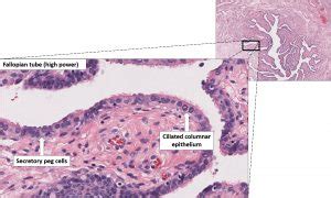 Fallopian Tube Normal Histology Nus Pathweb Nus Pathweb