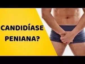 Como tratar a candidíase masculina 3 видео Med