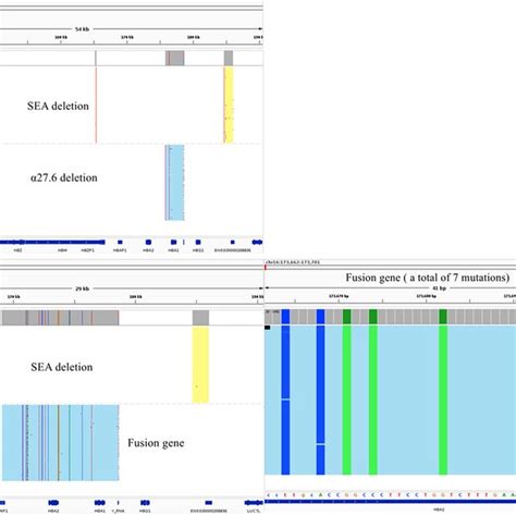 Integrative Genomics Viewer Igv Plots Of Common Nondeletional Hb H