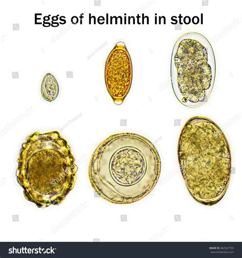 Egg Of Helminth In Stool Analyze By Microscope Stock Photo 462527755