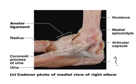 Ulnar Collateral Ligament Cadaver