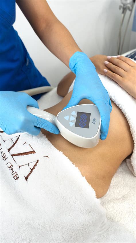 Exilis Ultra 360