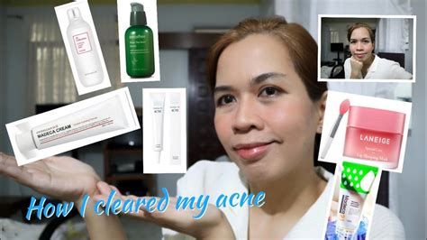 Skincare Routine How I Cleared My Acne Iheartdotie Youtube