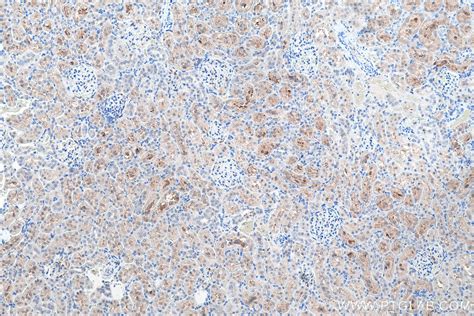 IHCeasy PRDX6 Ready-To-Use IHC Kit KHC0513 | Proteintech 