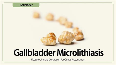 Linear Eus Gallbladder Microlithiasis Youtube