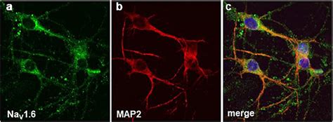 The Unexpected Role Of Nav16 Channels In Alzheimers Disease Alomone
