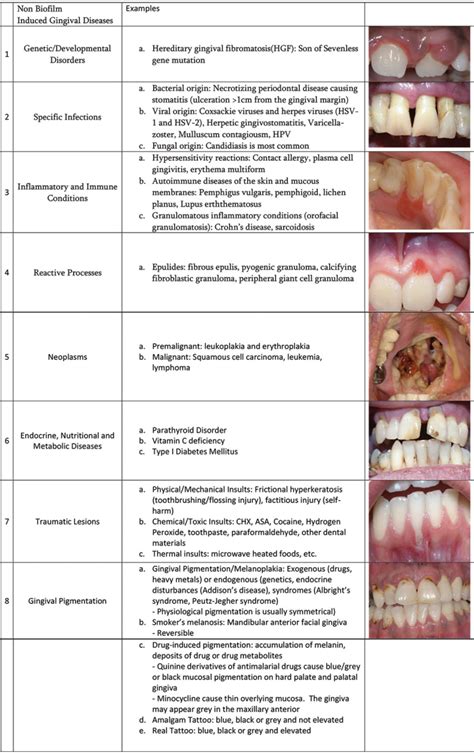 New Periodontal Classification System