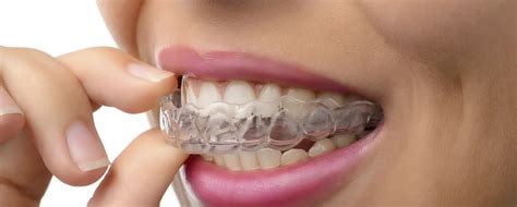 9 Best Over The Counter Mouth Guards For Teeth Grinding 2024