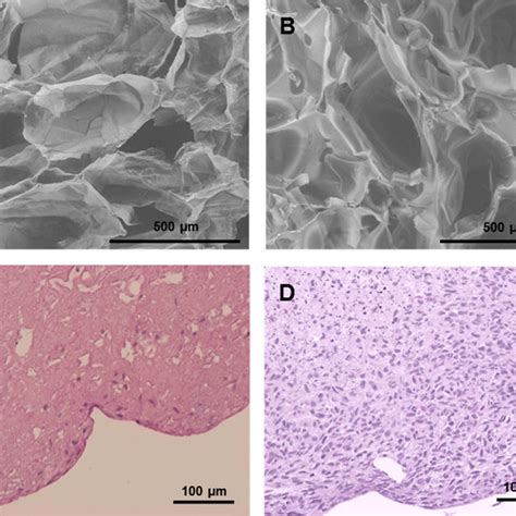 Cell Incorporation In The Collagen Scaffold And The Fibrin Clot Sem