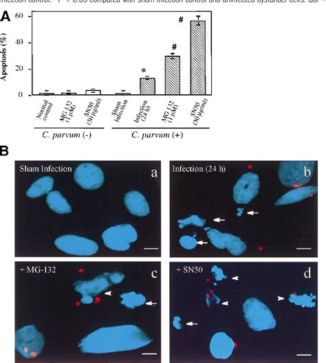 Figure From Cryptosporidium Parvum Activates Nuclear Factor Kappab In