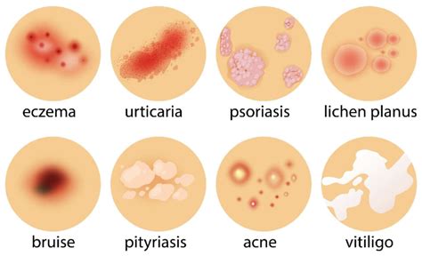 Various Examples Of Skin Conditions [3] Download Scientific Diagram