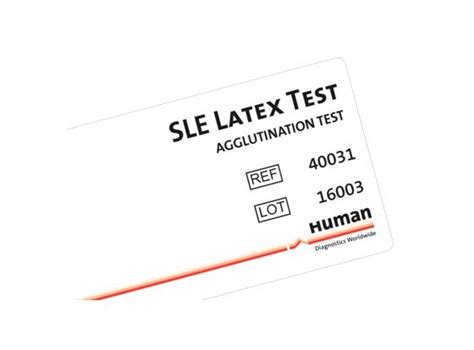 sle human diagnostics rapid test skroollmed