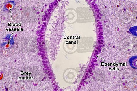 Mammal. Spinal cord. Transverse section. 500X - Spinal cord - Mammals - Mammals - Nervous system ...