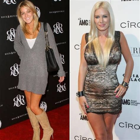 The Ever Changing Look Of Heidi Montags Before And After Plastic