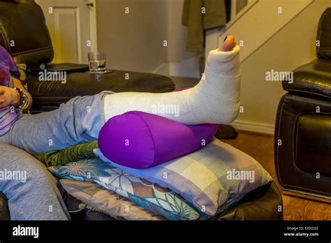 Lady With A Broken Ankle With Her Leg In An Elevated Position Stock