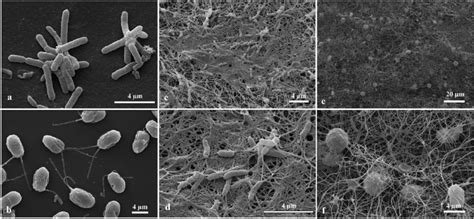 Scanning Electron Micrograph Of A The Cellulose Producing Bacteria A