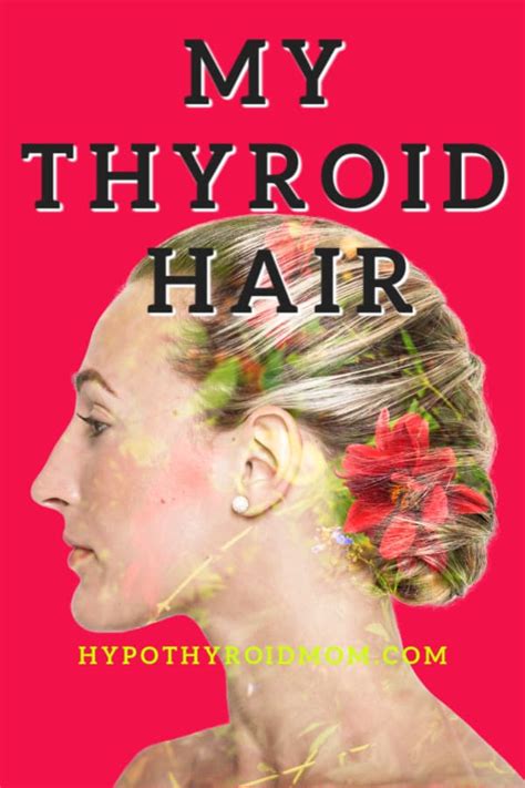 Most Helpful Thyroid Posts Hypothyroid Mom