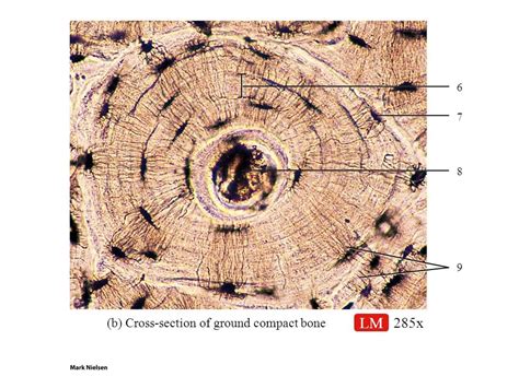 Osteon Ground Bone Slide Diagram Quizlet