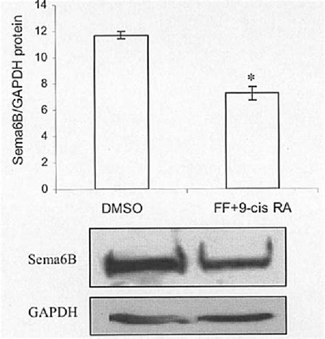 Figure 10 From Effects Of Ppar And Rxr Ligands In Semaphorin 6b Gene Expression Of Human Mcf 7