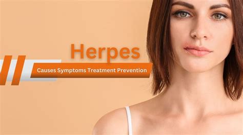 Herpes Causes Symptoms Treatment Prevention The Hiv Map