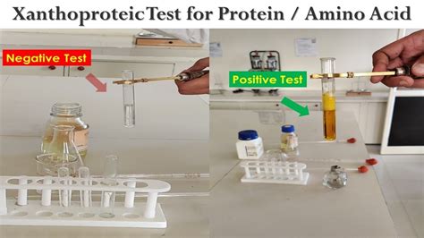 Xanthoproteic Test Youtube