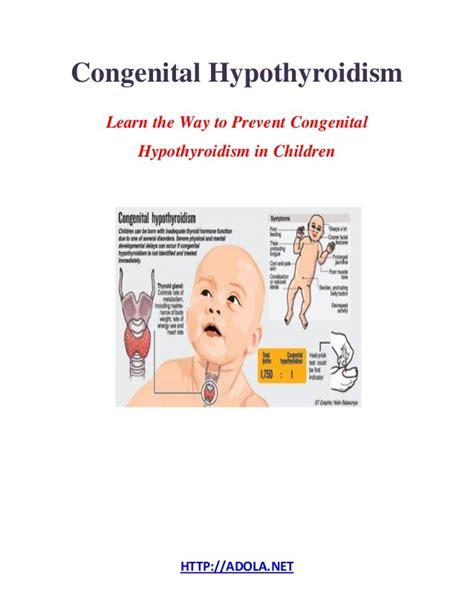 Congenital Hypothyroidism Learn The Way To Prevent Congenital Hypothy…