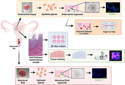 Frontiers Endometrial Stem Progenitor Cells Their Role In Endometrial