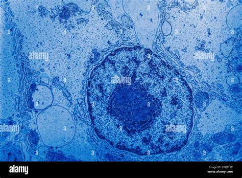 Nucleus Electron Micrograph