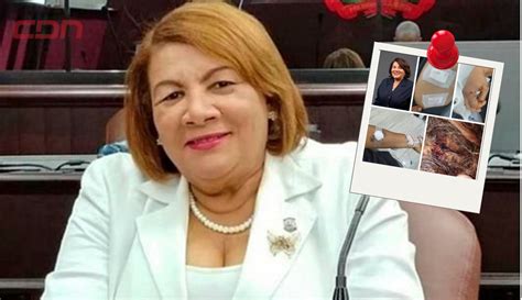 Proceso do Exdiputada peledeísta Cleo Sánchez es agredida con