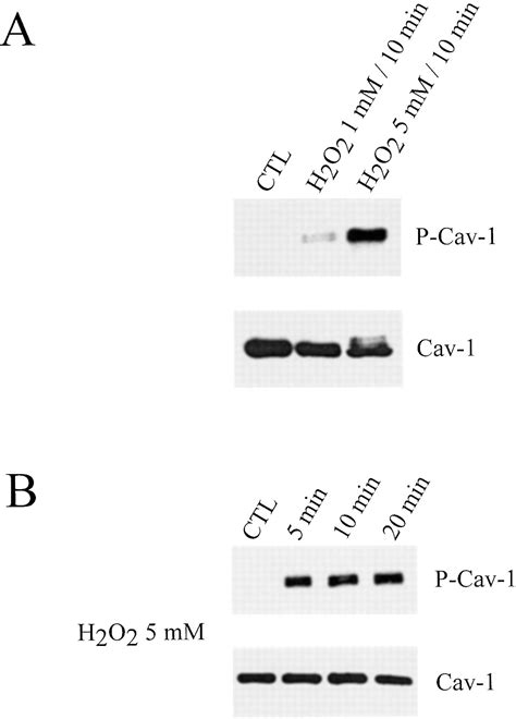 Cellular Stress Induces The Tyrosine Phosphorylation Of Caveolin