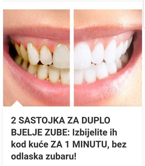 2 SASTOJKA ZA DUPLO BJELJE ZUBE Izbijelite ih kod kuće za 1 minutu