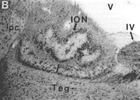 schematic drawing  photomicrograph   ion   drawing shows