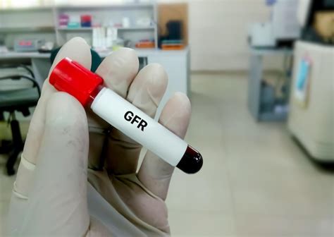 Premium Photo Blood Sample For Gfr Or Glomerular Filtration Rate Test