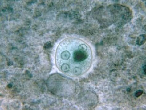 Entamoeba Histolytica Stepwards