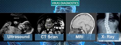 Vikas Diagnostics Best Diagnostics Lab In Kanpur