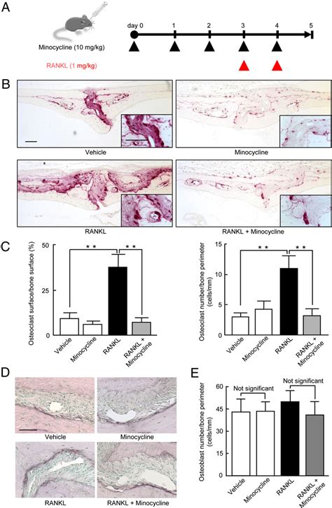 Figure 1 From Tetracyclines Convert The Osteoclastic Differentiation