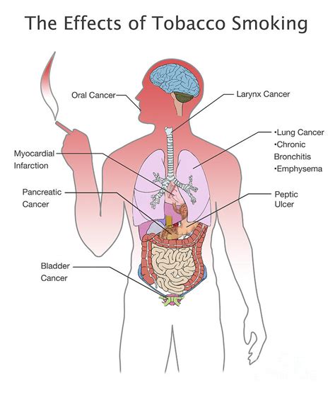 Effects Of Tobacco Smoking Photograph By Spencer Sutton