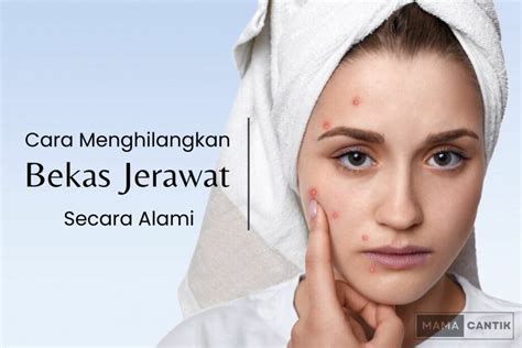 8 Cara Menghilangkan Bekas Jerawat Secara Alami Ampuh