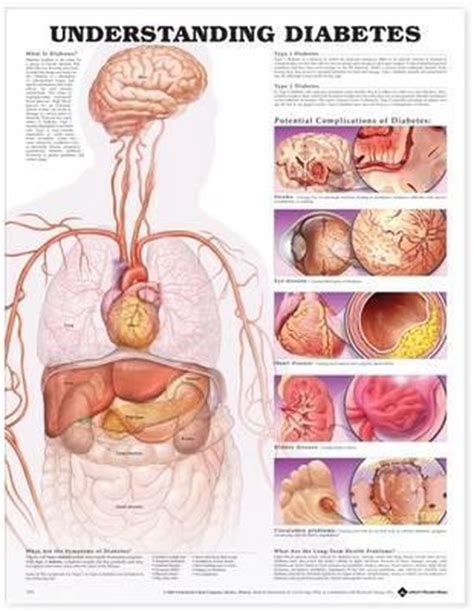 Understanding Diabetes Anatomical Chart