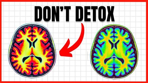 Dopamine Detox Isn T What You Need Youtube