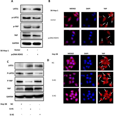 RDH5 Inhibits HCC Cellular Migration Through Suppressing Hippo YAP