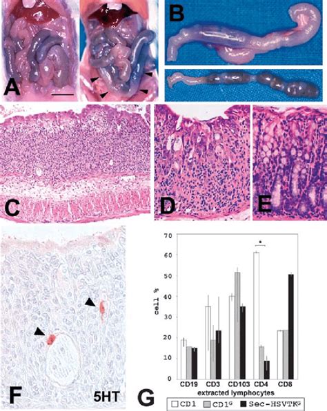 The Effect Of Ganciclovir Treatment In The Colon Of Sec Hsvtk Mice And