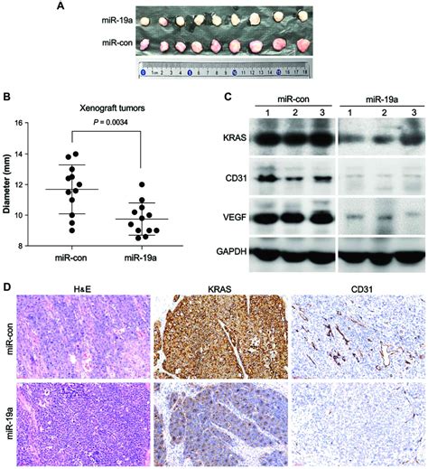 Overexpression Of MiR 19a Inhibits Colorectal Cancer Angiogenesis By