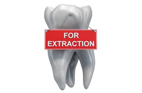 920+ Tooth Extraction Stock Photos, Pictures & Royalty-Free Images - iStock 