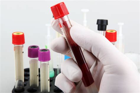 blood tests  swindon kube medical