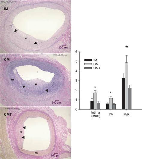 Effect Of Testosterone On Neointimal Response To Moderate Injury Left