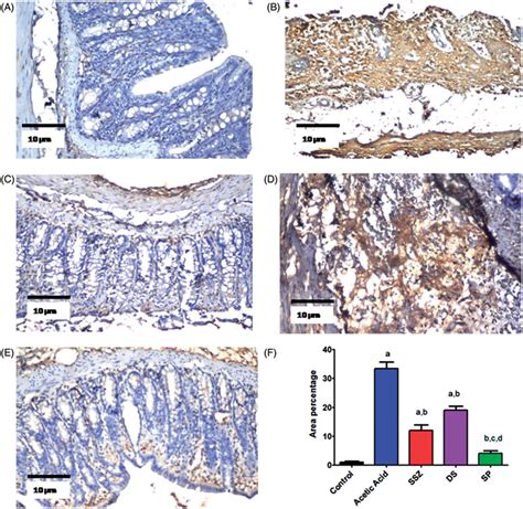 Immunohistochemical Staining By Inos Antibody In Colonic Sections Of