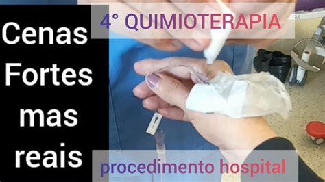 Cenas Fortes Quimioterapia Minha Quimioterapia Vermelha Youtube