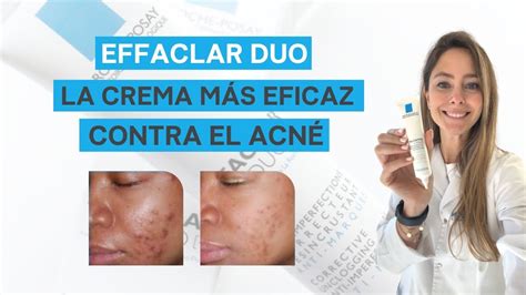 EFFACLAR DUO de La Roche Posay la MEJOR crema para el ACNÉ Mi