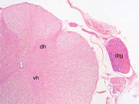 Dorsal root ganglion